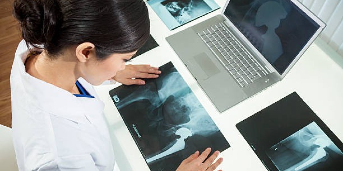 Hip Replacement Surgery in India: A Gateway to Affordable and Quality Healthcare