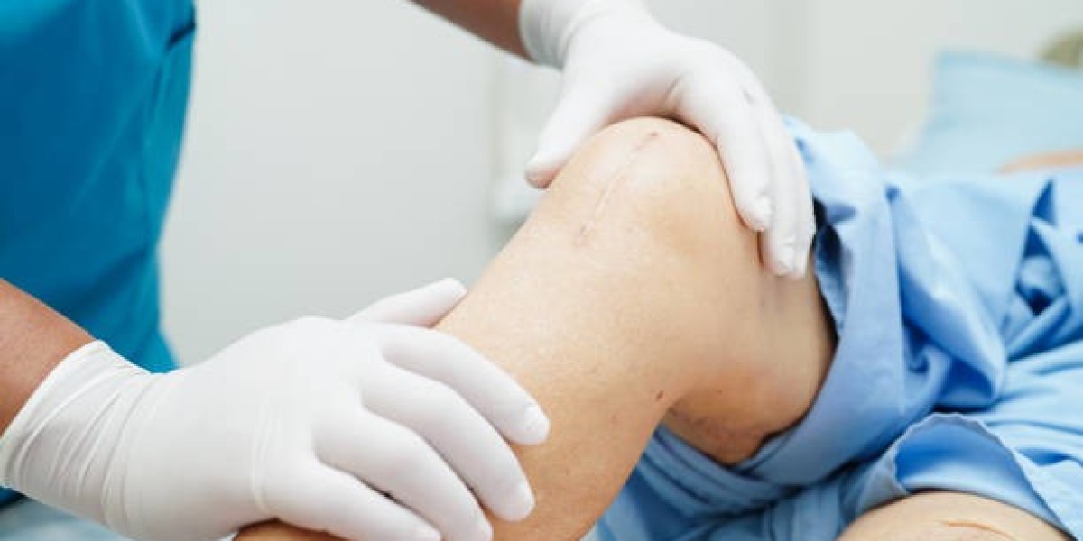 Knee Replacement Surgery in India: Why It's a Top Choice for Medical Tourists